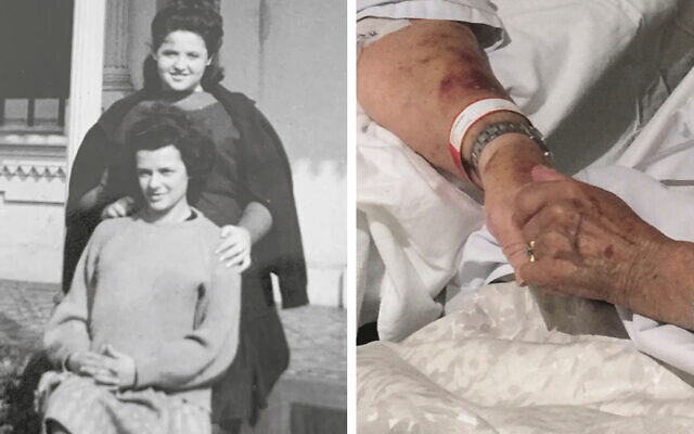 Left: Asia Gutmann (back) and
Vera Friedman as teenagers. Right: Vera and Asia holding hands in their
hospital beds.