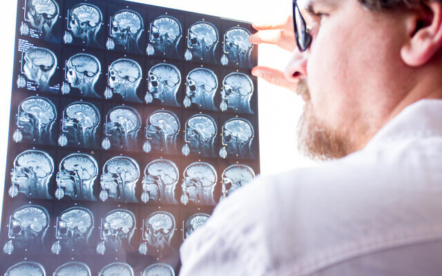 Illustrative image: A doctor evaluates results of magnetic resonance imaging of a brain. (iStock via Getty Images)