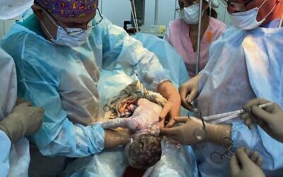Doctors delivered a baby via caesarean section last Thursday.
