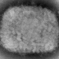 تُظهر صورة المجهر الإلكتروني هذه لعام 2003 التي قدمها مراكز السيطرة على الأمراض والوقاية منها فيروس جدري القردة، تم الحصول عليه من عينة مرتبطة بتفشي المرض عام 2003. (Cynthia S. Goldsmith, Russell Regner/CDC via AP)