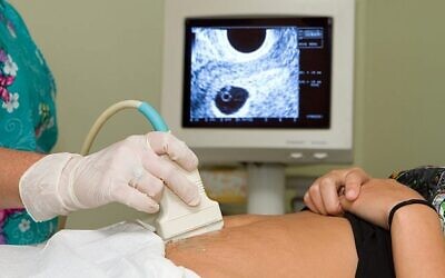 A general depiction of a women getting an ultrasound.