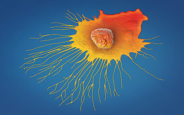 تصویر تزئینی: عکس آرشیو از سلول سرطانی پستان. (Christoph Burgstedt via iStock by Getty Images)