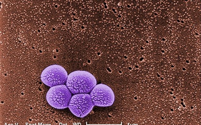 Agrandi de 20 000X, ce micrographe électronique à balayage (MEB) coloré représente un groupe de bactéries Staphylococcus aureus (MRSA) résistantes à la méthicilline. (Crédit : Janice Carr/Public Health Image Library PHIL)