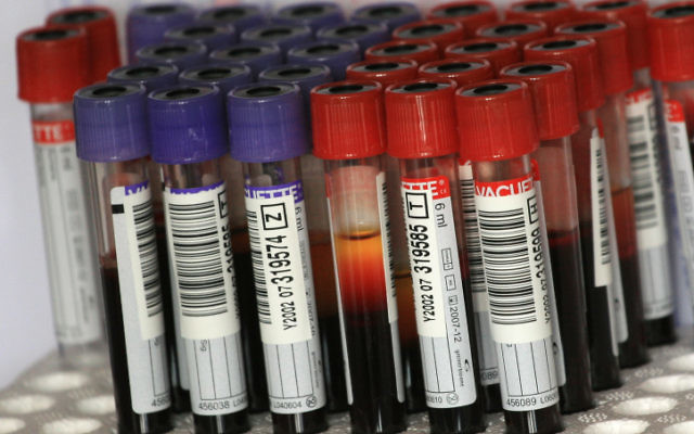 Test tubes filled with blood samples (Illustrative photo credit: Rebecca Zeffert/Flash90)