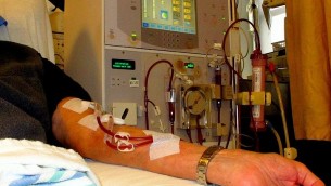 Un patient sous dialyse. Illustration. (Crédit : Anna Frodesiak/Wikimedia Commons)