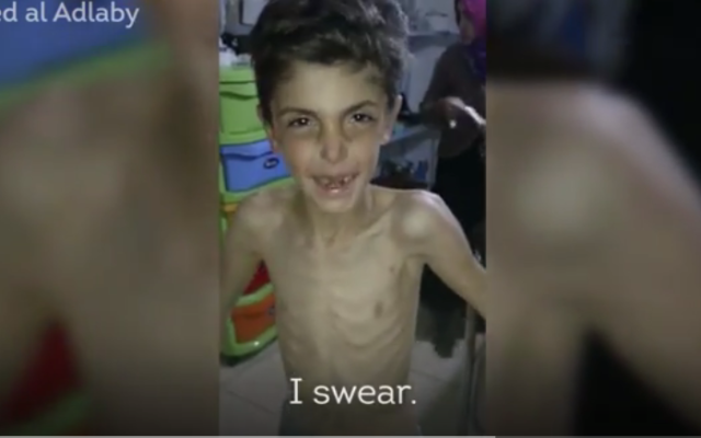 Capture d'écran de la vidéo devenue virale d'un enfant syrien qui n'aurait pas mangé depuis 7 jours (Crédit : Capture d'acran YouTube)