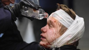 Les policiers soignent un militant blessé du Mouvement de résistance nordique (NMR) dans le centre de Stockholm, en Suède, le 12 novembre 2016. (Crédit : AFP/Jonathan Nackstrand)