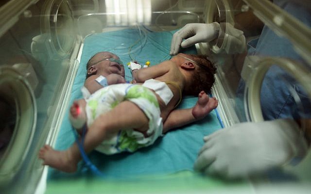 Des jumelles siamoises palestiniennes dans une couveuse le 22 octobre 2017 à l'hôpital al-Shifa de la ville de Gaza (Crédit : MAHMUD HAMS / AFP)