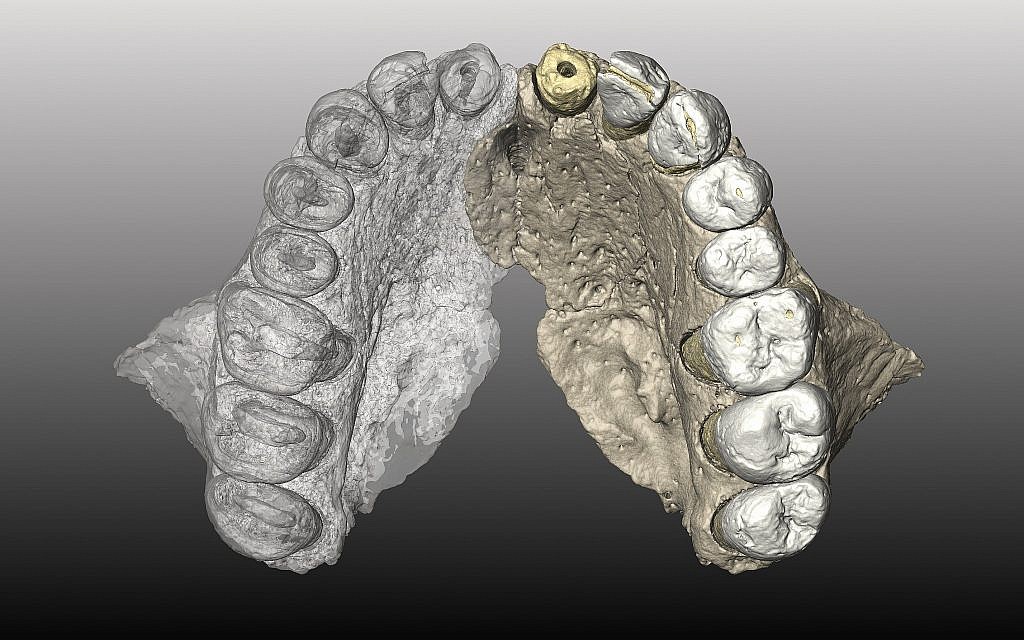 L'os maxillaire reconstruit en micro-images CT à partir de la mâchoire (supérieure) de l'hominien Misliya-1. (Crédit : Gerhard Weber, Université de Vienne, Autriche)