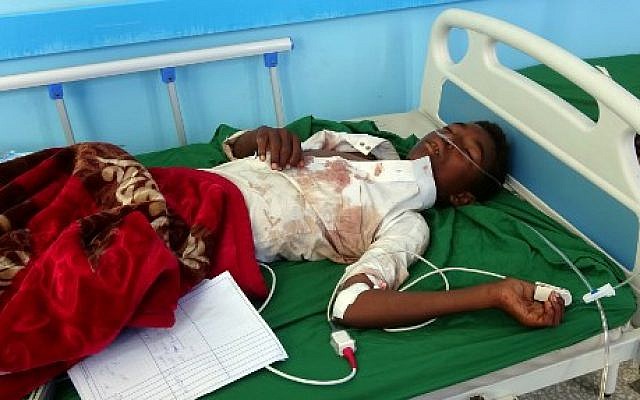 Un garçon yéménite, blessé lors d'un raid aérien sur une fête de mariage au Yémen, reçoit un traitement dans un hôpital de la province du Hajj au Yémen le 23 avril 2018. (Crédit : AFP/ESSA AHMED)