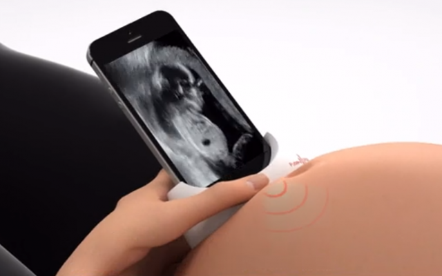 Image informatisée d'un dispositif par ultra-son en développement dans la start-up israélienne PulseNmore qui permettrait à une femme enceinte de vérifier que tout va bien chez son bébé via smartphone. (Capture d'écran : Hadashot)