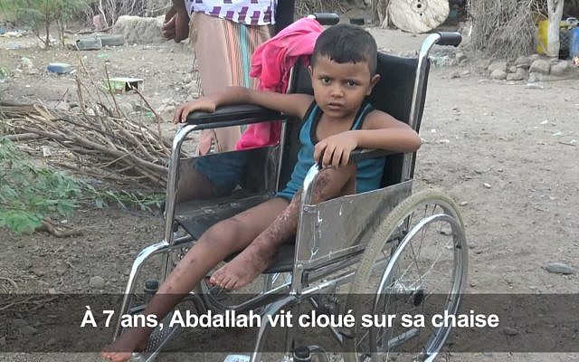 Au Yémen, Abdallah, un enfant de 7 ans victime des mines. (Crédit : Capture d'écran AFPTV via YouTube)