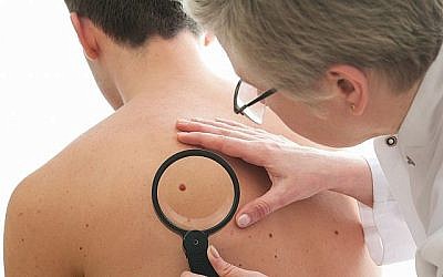 Image d'un dermatologue qui vérifie un grain de beauté d'un patient pour détecter des signes d'un mélanome. (AlexRaths; iStock par Getty Images)