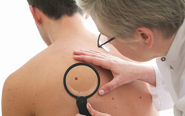 Image d'un dermatologue qui vérifie un grain de beauté d'un patient pour détecter des signes d'un mélanome. (AlexRaths; iStock par Getty Images)