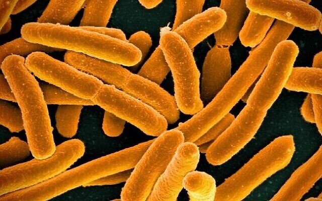 Bactérie E. coli. (NIAID/Wikimedia Commons, CC BY 2.0) ,