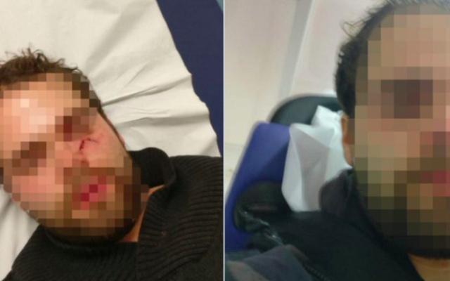 Yogev B. attaqué dans le métro parisien, le 9 décembre 2019, dans un wagon de la station Château d'eau sur la ligne 4 (Crédit : autorisation)