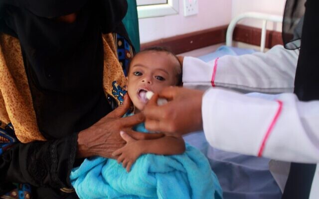 Une infirmière s'occupe d'un enfant yéménite souffrant de malnutrition, dans un centre de traitement dans la province de Hajjah, dans le nord du Yémen, le 5 juillet 2020. (ESSA AHMED / AFP)