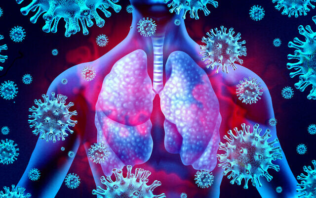 Photo d'illustration : Des poumons infectés par le coronavirus. (Crédit : wildpixel via iStock by Getty Images)