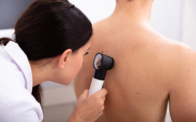 Une dermatologue examinant un patient pour un éventuel cancer de la peau. (AndreyPopov via iStock by Getty Images)