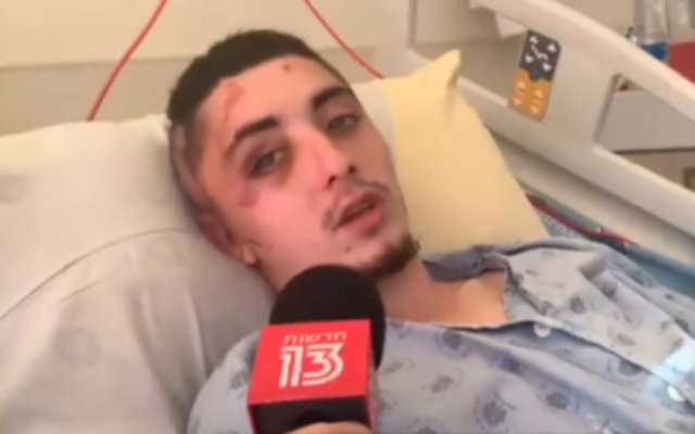 Leon Shranin, 19 ans, grièvement blessé par une foule arabe lors des émeutes à Jaffa, en mai 2021. (Crédit : La Treizième chaîne)