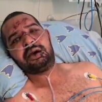 Saeed Mousa, un Arabe israélien agressé par des extrémistes juifs, à l'hôpital Ichilov, le 14 mai 2021. (Capture d'écran)