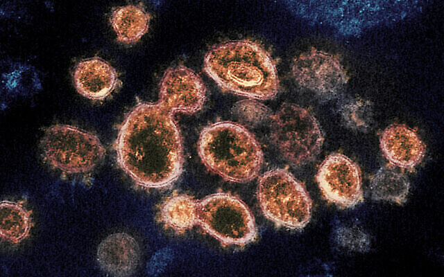 Particules du virus SRAS-CoV-2, à l'origine du COVID-19, isolées chez un patient aux États-Unis, émergeant de la surface de cellules cultivées en laboratoire. (Crédit : NIAID-RML via AP) 