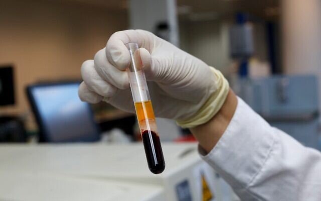 Un laborantin israélien tient un échantillon de sang lors de tests sérologiques au laboratoire Leumit Health Care Services à Or Yehuda, près de Tel Aviv, le 29 juin 2020. Illustration (Crédit : GIL COHEN-MAGEN / AFP)