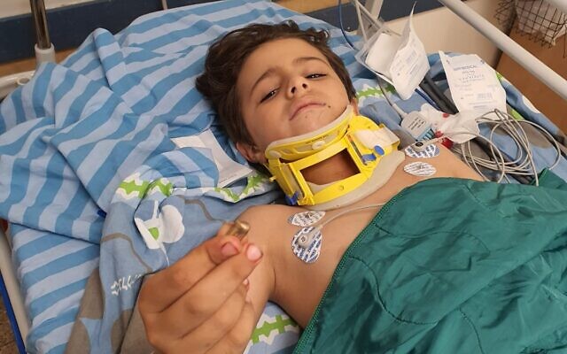 Yousef Sammir Alafenish montre la balle qui l'a touché à la nuque depuis son lit d'hôpital, à l'hôpital Soroka de Beer Sheva. (Autorisation)
