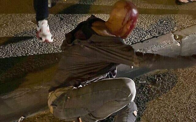 Un homme israélien attaqué après être entré dans le quartier d'Issawiyah à Jérusalem-Est le 15 mai 2022 (Crédit : Twitter)