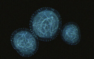 Virus de la variole du singe (Crédit : Udomkarn Chitkul/iStock/Getty Images)