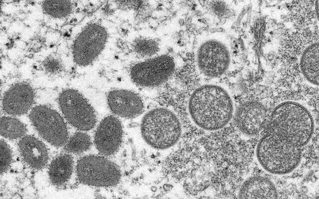 Des virions matures, de forme ovale de variole du singe, à gauche, et des virions encore immatures, sphérique, observés au microscope sur une peau humaine, une image fournie par les CDC américain en 2003. (Crédit :  Cynthia S. Goldsmith, Russell Regner/CDC via AP)