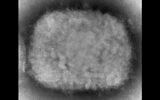 Cette image obtenue au microscope montre un virion de variole du singe, isolé dans un échantillon humain au cours d'une épidémie qui avait eu lieu en 2003. (Crédit : Cynthia S. Goldsmith, Russell Regner/CDC via AP)