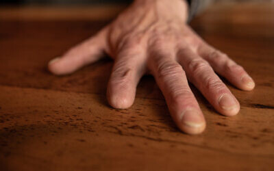 Photo d'illustration : Une main amputée sur une table en bois. (Crédit : BW Studio; iStock by Getty Images)