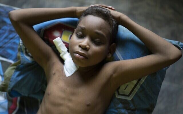 Illustration : Angel Cespedes, 14 ans, en attente d’une greffe de rein, se repose après une dialyse à domicile, à Valles del Tuy, à la périphérie de Caracas, au Venezuela, le 8 novembre 2021. (Crédit : AP Photo/Ariana Cubillos)