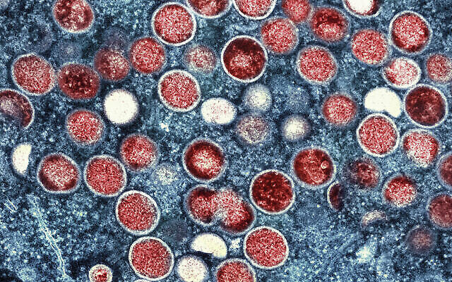 Cette image fournie par le National Institute of Allergy and Infectious Diseases (NIAID) montre une micrographie électronique à transmission colorisée de particules de variole du singe (rouge) trouvées dans une cellule infectée (bleu), cultivée en laboratoire à l'Integrated Research Facility (IRF) du NIAID à Fort Detrick, dans le Maryland. (Crédit : NIAID via AP)