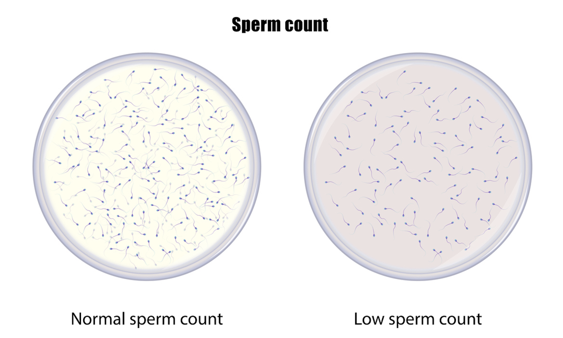 Le nombre de spermatozoïdes a chuté de 62 % en moins de 50 ans ...