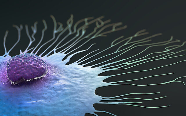 Illustration. Une cellule cancéreuse du sein chez l'homme. (Crédit : Christoph Burgstedt ; iStock by Getty Images)