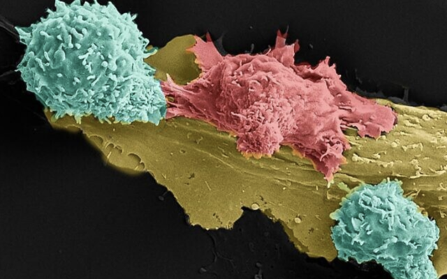 Deux cellules immunitaires en vert combattant une cellule cancéreuse en rouge, dans la nouvelle immunothérapie inventée dans le laboratoire du professeur Cyrille Cohen à l'université Bar Ilan. (Crédit : Cyrille Cohen, Tilda Barliya et Astar Shamul)