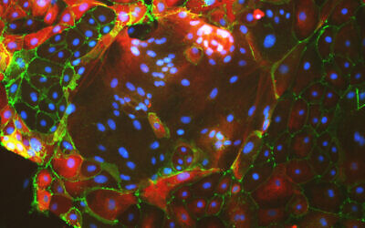 Des cellules multinucléées du placenta. (Crédit : Moriyah Naama/Buganim Lab Université hébraïque)