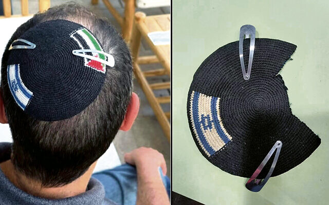 Dr. Sinclair’s kippah on his head, and as the police officer in Modi’in returned it to him. Dr. Sinclair’s kippah on his head, and as the police officer in Modi’in returned it to him.