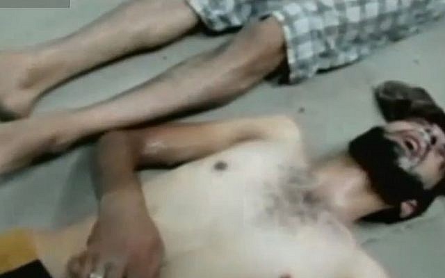 A reported victim of the August 21 chemical attack near Damascus. (Screenshot CNN via Youtube)