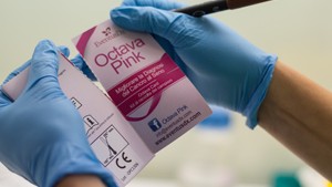 Octava blood tests, developed for rapid, accurate detection of breast cancer tumors (photo credit: EventusDx)