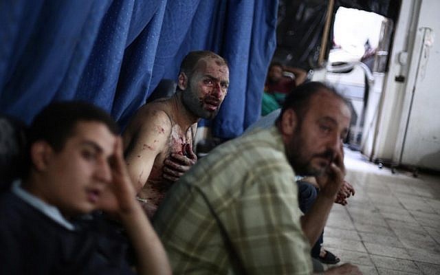 Wounded Syrian men wait for treatment at a makeshift hospital in the rebel-held town of Douma near Damascus on September 9, 2014, after reported airstrikes by Syrian government forces that killed over 10 people and wounded dozens. (photo credit: AFP/ABD DOUMANY)