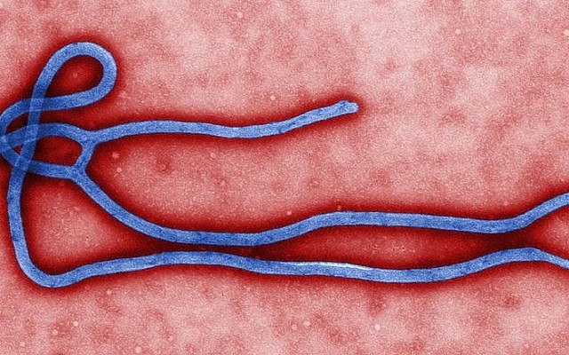 Electron micrograph of an Ebola virus virion (photo credit: CDC microbiologist Cynthia Goldsmith/Wikimedia)