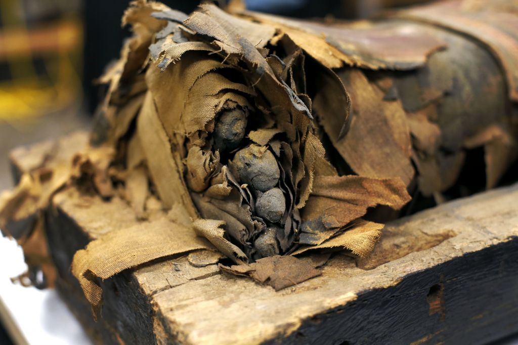 In this photo taken Friday, Dec. 5, 2014, in Chicago, the mummified body of Minirdis, a 14-year-old Egyptian boy and his exposed toes lie in his opened coffin after J.P. Brown and his team of curators at the Field Museum opened the coffin for the first time to begin a conservation process on the 2,500-year-old boy before it becomes part of a traveling exhibition. (photo credit: AP/Charles Rex Arbogast)