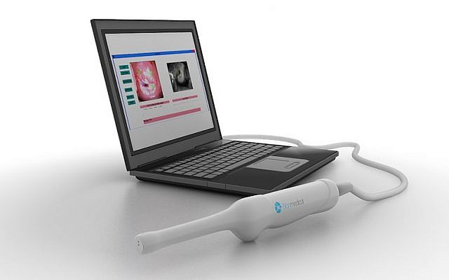 The Biop device connected to a laptop, where it downloads the data gathered in an examination. (photo credit: Courtesy)