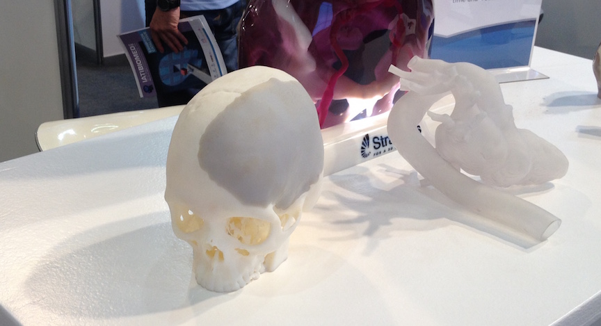 Model of a human skull printed on a 3D printer (Photo credit: Courtesy