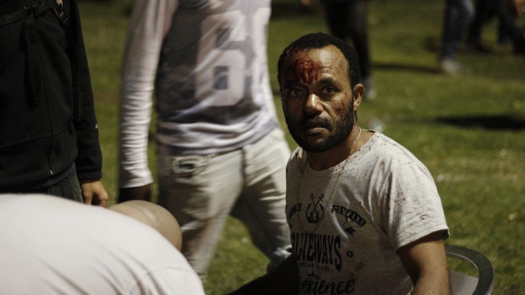 An Ethiopian Israeli man receives medical treatment after being injured at an anti-police brutality demonstration in Tel Aviv's Rabin Square on Sunday, May 3, 2015. (photo credit: Judah Ari Gross/Times of Israel staff)