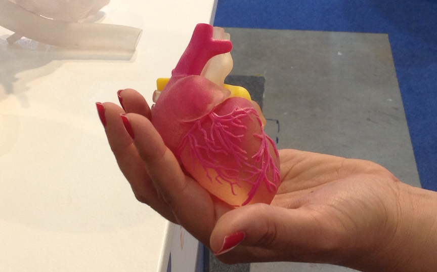 Model of a human heart printed on a 3D printer (Photo credit: Courtesy
