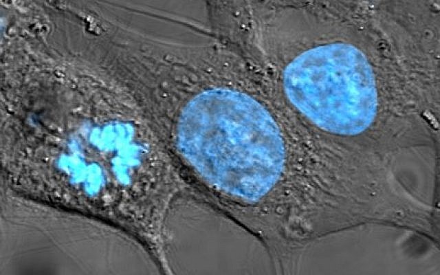 Human cancer cells with nuclei (specifically the DNA) stained blue. The central and right-most cell are in interphase, so the entire nuclei are labeled. The cell on the left is going through mitosis and its DNA has condensed.  (TenOfAllTrades/Wikipedia)